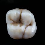 Artificial intelligence in everyday dental practice: the largest implementation by VideaHealth and Aspen Dental