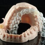 Temporary Prosthetics with 3D Printing: Personalized Solutions and Transformation of Clinical Practice